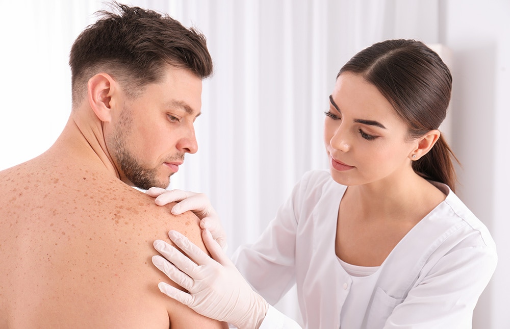 Cómo distinguir un lunar de un melanoma