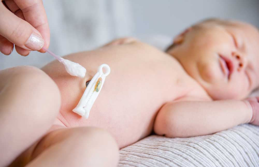 Como cuidar el ombligo del bebé